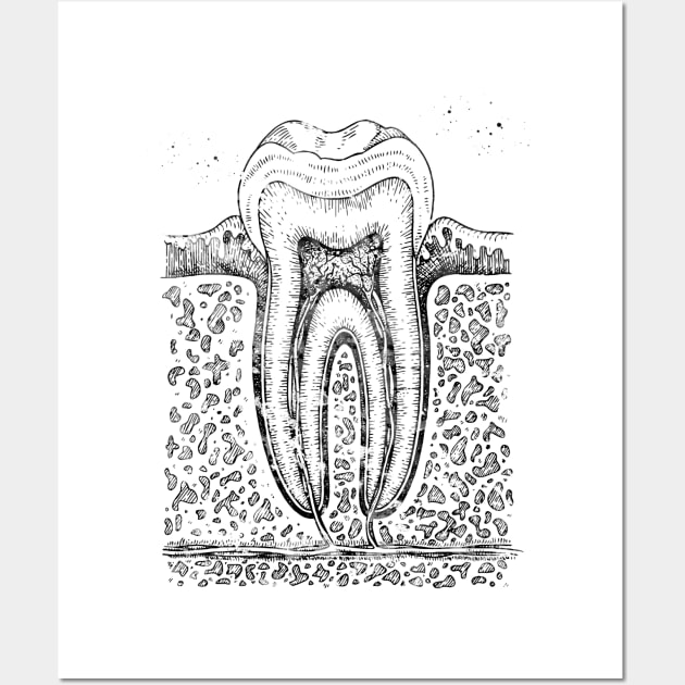 Tooth diagram Wall Art by erzebeth